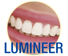 Lumineers™